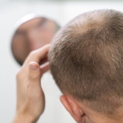 Motivos que causan caída del cabello