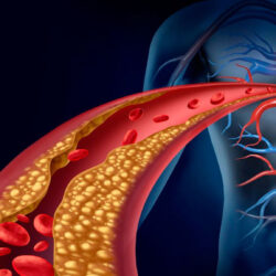 Probióticos para reducir el colesterol y mejorar tu salud cardiovascular